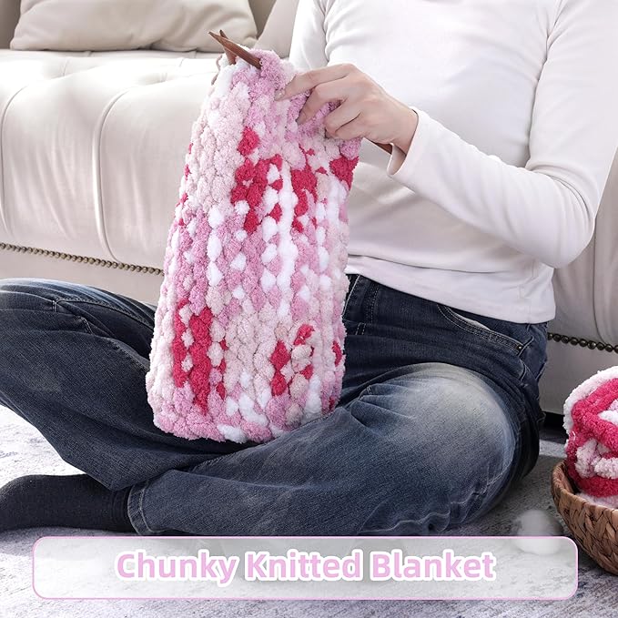 HOMBYS Chunky Tie Dye Mix Chenille Yarn for Hand Knitting, Super Bulky Jumbo Yarn for Crocheting, 3/4" Thick Soft Plush Yarn for Blankets, 8 Skein Pack (26 yds / 7.5 oz Each) Rose,Pink,White